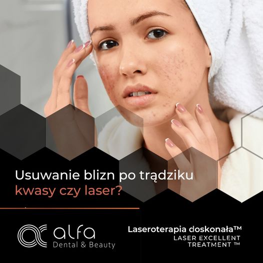 Leczenie blizn potrądzikowych Krak&oacute;w