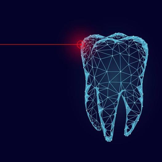 Zalety z korzystania metody laserowej w stomatologii estetycznej